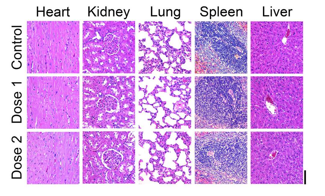 H&E stained histological cuts of heart, kidney, lung, spleen and liver showing a normal morphology after Exo-101 administration. From Rodrigues et al., Membranes 2021